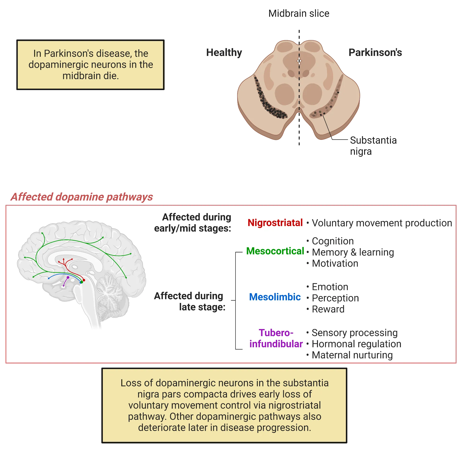 Top: A horizontal slice of brainstem showing a healthy example substantia nigra (with black cell bodies) on the left and substantia nigra with Parkinson's disease (and very few black cell bodies) on the right. Bottom: Left: a sagittal surface view of a human brain, with major dopaminergic pathways drawn from midbrain regions, projecting to cortex and striatum. Right: a list of the dopaminergic pathways affected by Parkinson's disease. Early/mid: Nigrostriatal; Late: Mesocortical, mesolimbic, tubero-infundibular