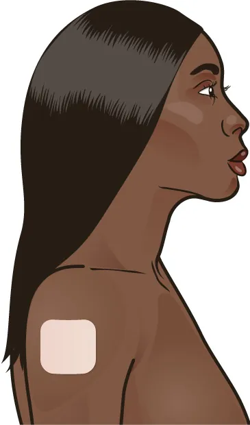 Image of a female with a square contraceptive patch on her upper, outer arm.
