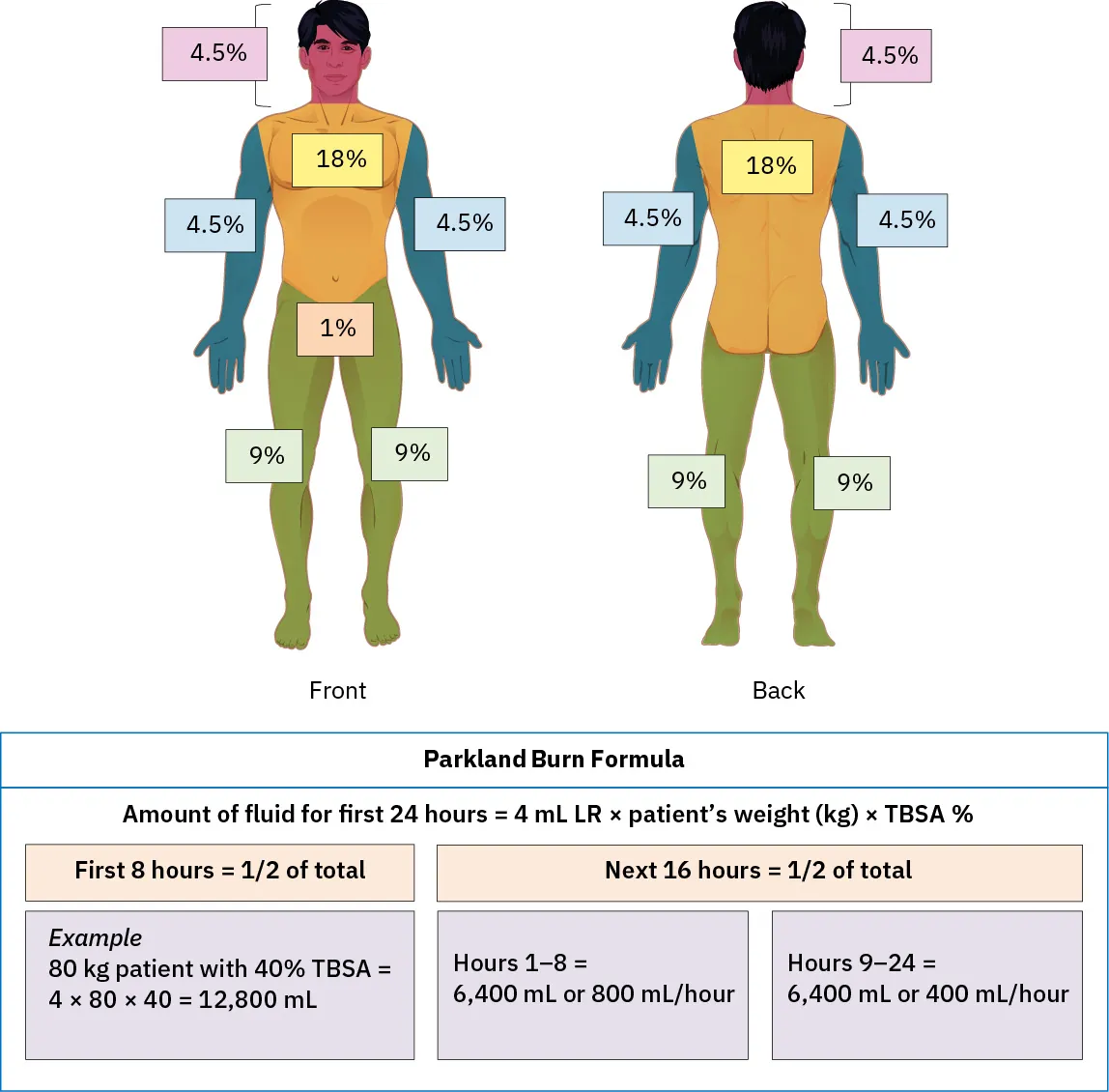 An illustration demonstrating the Parkland burn formula.