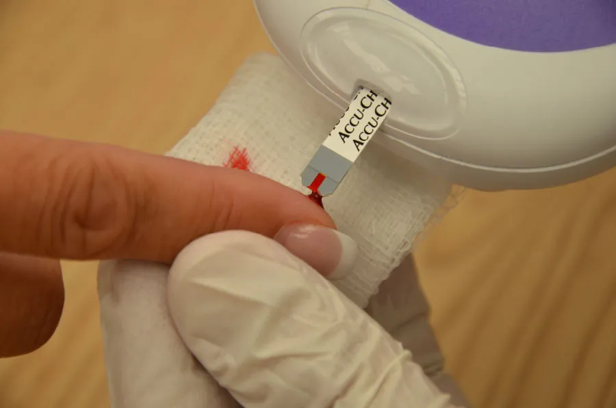 A photo of a lancet puncturing a patient’s finger and drawing blood for a capillary blood test.