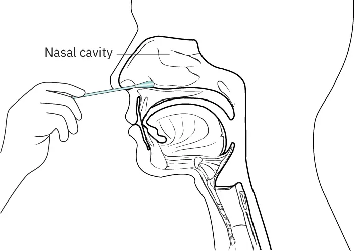 Graphic of a swab being inserted into a person’s nose.