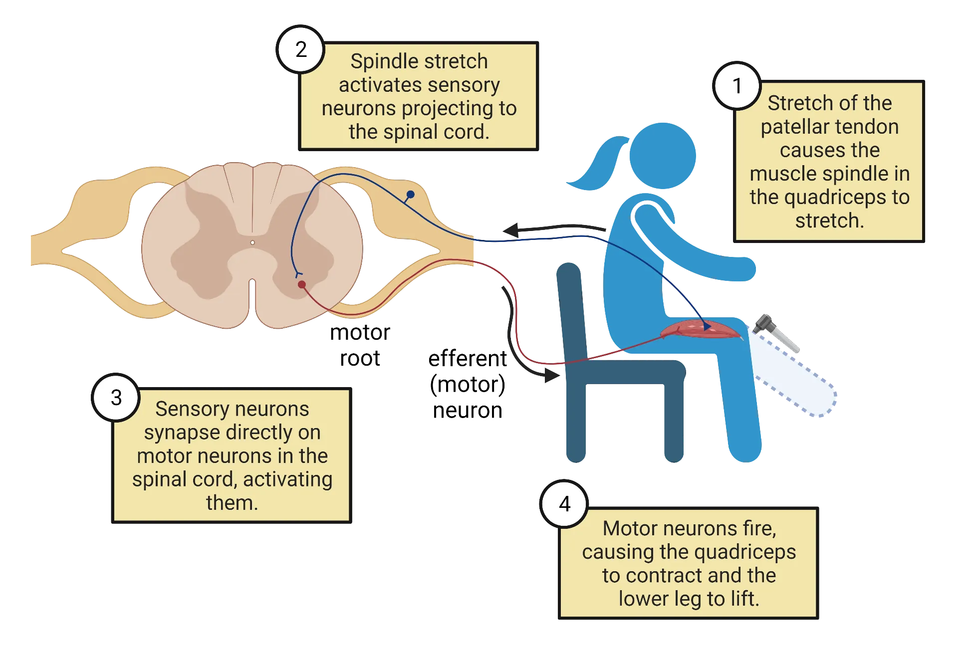 A diagram of a person sitting in a chair, with quadriceps muscle shown with a sensory neuron connecting to it. The sensory neuron originates in a horizontal section of spinal cord. It connects to a ventral grey matter motor neuron, which in turn projects back out the quadriceps muscle.