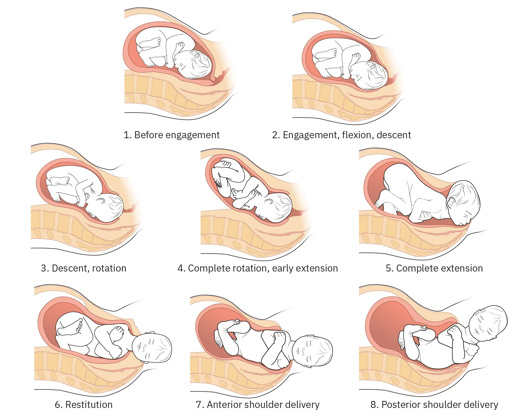 Mechanisms of labor: 1. Before engagement; 2. Engagement, flexion, descent; 3. Descent, rotation; 4. Complete rotation, early extension; 5. Complete extension; 6. Restitution; 7. Anterior shoulder delivery; 8. Posterior shoulder delivery.