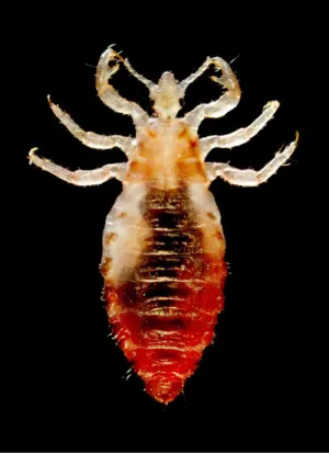 A photograph of a louse.
