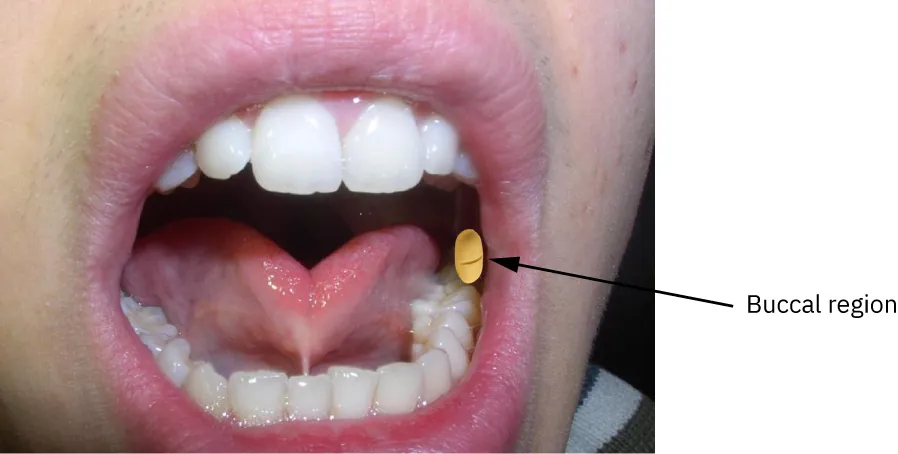 A photograph shows medication being administered between gum and cheek with buccal region labeled.