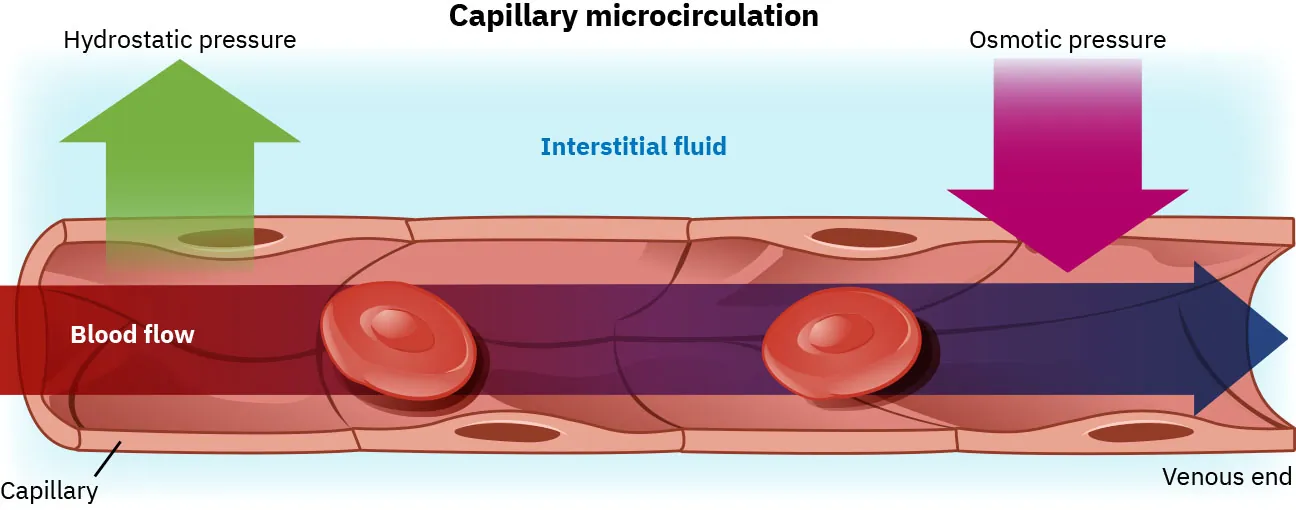 A color graphic showing blood flowing through a capillary to the venous end. There are four arrows showing 1) blood flow through the capillary to the venous end, 2) hydrostatic pressure flowing from the capillary into the interstitial fluid, and 3) osmotic pressure flowing from the interstitial fluid into the capillary. The title of the graphic is Capillary microcirculation.