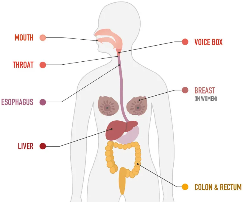 Diagram of body, labeling mouth, throat, esophagus, liver, voice box, breast (in women), colon & rectum