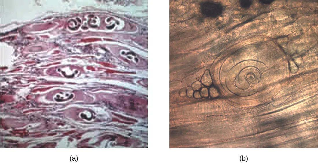 a) a micrograph of worms in bubbles within muscle tissue. B) a micrograph of a coiled worm on muscle.