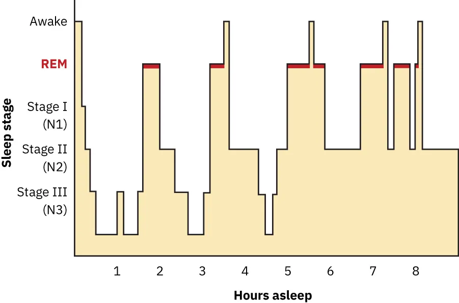 Hypnogram showing the transitions of the sleep cycle during a typical eight hour period of sleep. During the first hour, the person goes through stages 1 and 2, ending at 3. In the second hour, sleep oscillates in stage 3 before attaining a 30-minute period of REM sleep. The third hour follows the same pattern as the second, but ends with a brief awake period. The fourth hour follows a similar pattern as the third, with a slightly longer REM stage. In the fifth hour, stage 3 is no longer reached. The sleep stages are fluctuating from 2, to 1, to REM, to awake, and then they repeat with shortening intervals until the end of the eighth hour when the person awakens.