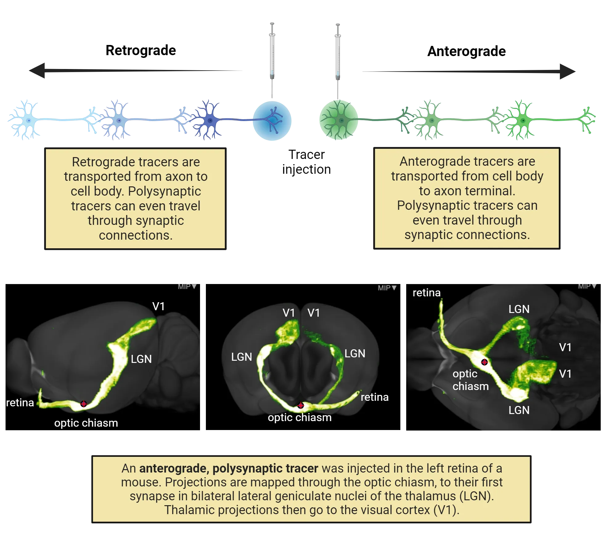 Top of image shows a diagram of a needle infusing a tracer near the axon terminals of one neuron and near the dendrites of another. Anterograde tracers are shown being transported from cell body to axon terminal, including moving into neurons connected to the first neuron (polysynaptic). Retrograde tracers are shown being transported from axon to cell body, including moving into neurons connected to the first neuron (polysynaptic). The bottom of the image shows a 3D rendering of a pathway extending from the rostral end of a mouse brain to the caudal end. An anterograde, polysynaptic tracer was injected in the left retina of a mouse. Projections are mapped through the optic chiasm, to their first synapse in bilateral lateral geniculate nuclei of the thalamus (LGN). Thalamic projections then go to the visual cortex (V1).