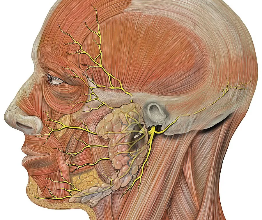 An image of the nerve branches affecting the facial muscles.