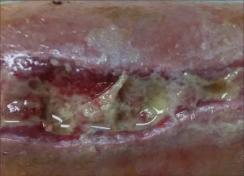 An image showing slough.