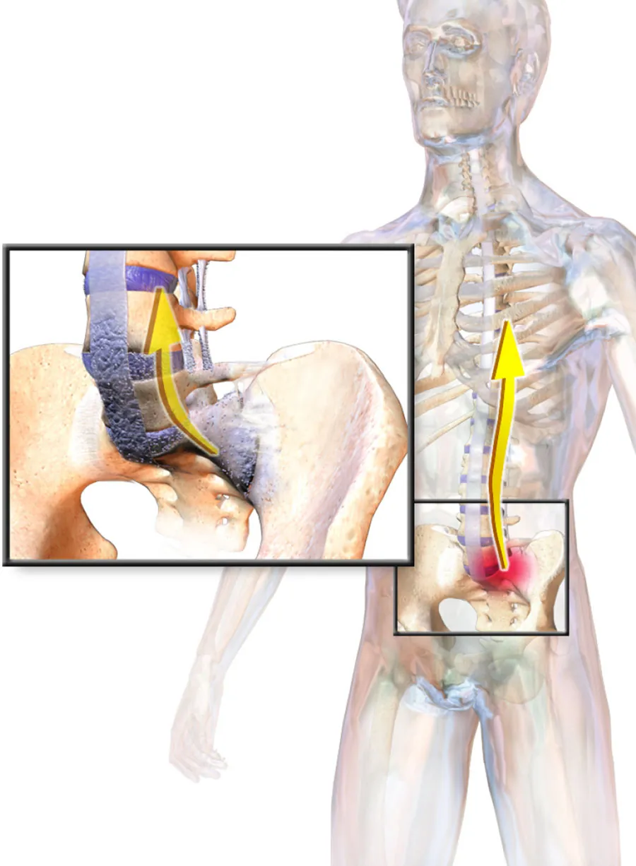 The image is an anatomical illustration of a semi-transparent human figure with a detailed inset focusing on the hip joint. The inset highlights the hip bones, cartilage, and the head of the femur. A yellow arrow in the main figure points down the spinal column to the hip area, suggesting the direction of force or movement related to the joint.