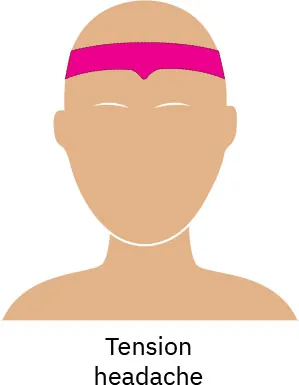 A drawing of a person’s face with a pink highlight around the forehead, showing where pain caused by tension is reflected.