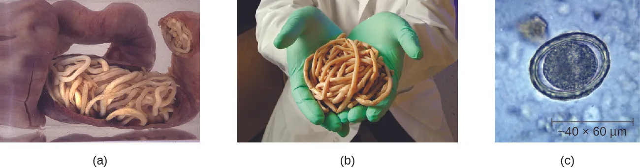 a) phot of worms filling the intestines. B) photo of a large handful of worms. C) photo of a circle in a thicker circle. The outer circle is about 60 micrometers.