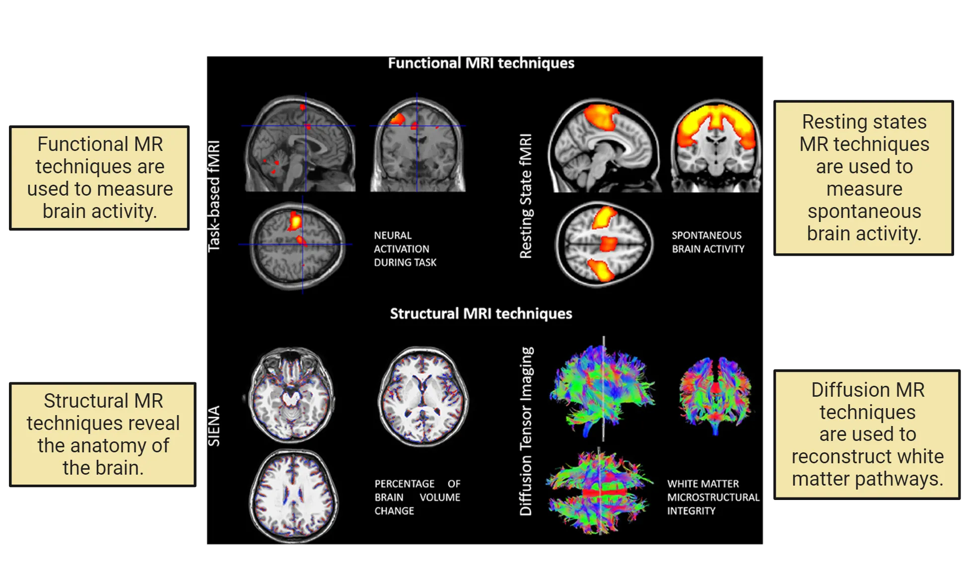 Example scans from functional MR, structural MR, resting states MR and diffusion MR. Each example shows multiple slice images. Functional MR shows colorful hot spots in discrete pockets. Structural MR shows brain structure. Resting states MR shows colorful hotspots like function MR but the spots are larger and cover more of the brain. Diffusion MR is a cluster of multicolored strings representing white matter pathways. In aggregate, they create a brain-shaped outline. The substrates measures by each technique are also summarized from the main text.