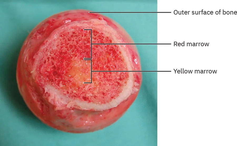 The image is a close-up of a cross-section of a bone placed on a teal surgical cloth, labeled to show the outer surface of the bone, with areas of red marrow in the center and a ring of yellow marrow surrounding it.
