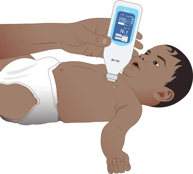 Image of a transcutaneous bilirubinometer being hold to an infant’s chest.