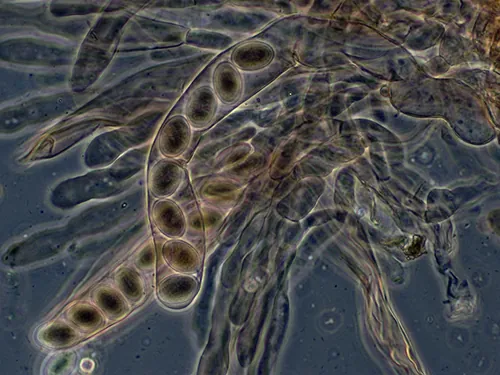 A micrograph showing a thick tube with 8 ovals lined up within the tube.