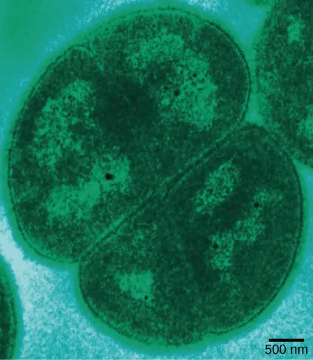 This micrograph shows an oval Deinococcus cell about 2.5 microns in diameter, dividing.