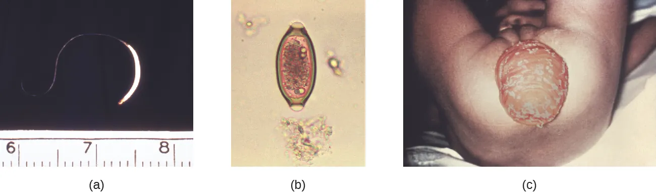 a) a micrograph of a worm about 2 inches in length. B) a micrograph of an oval cell. c) A photo of a large protruding sac from the anus.