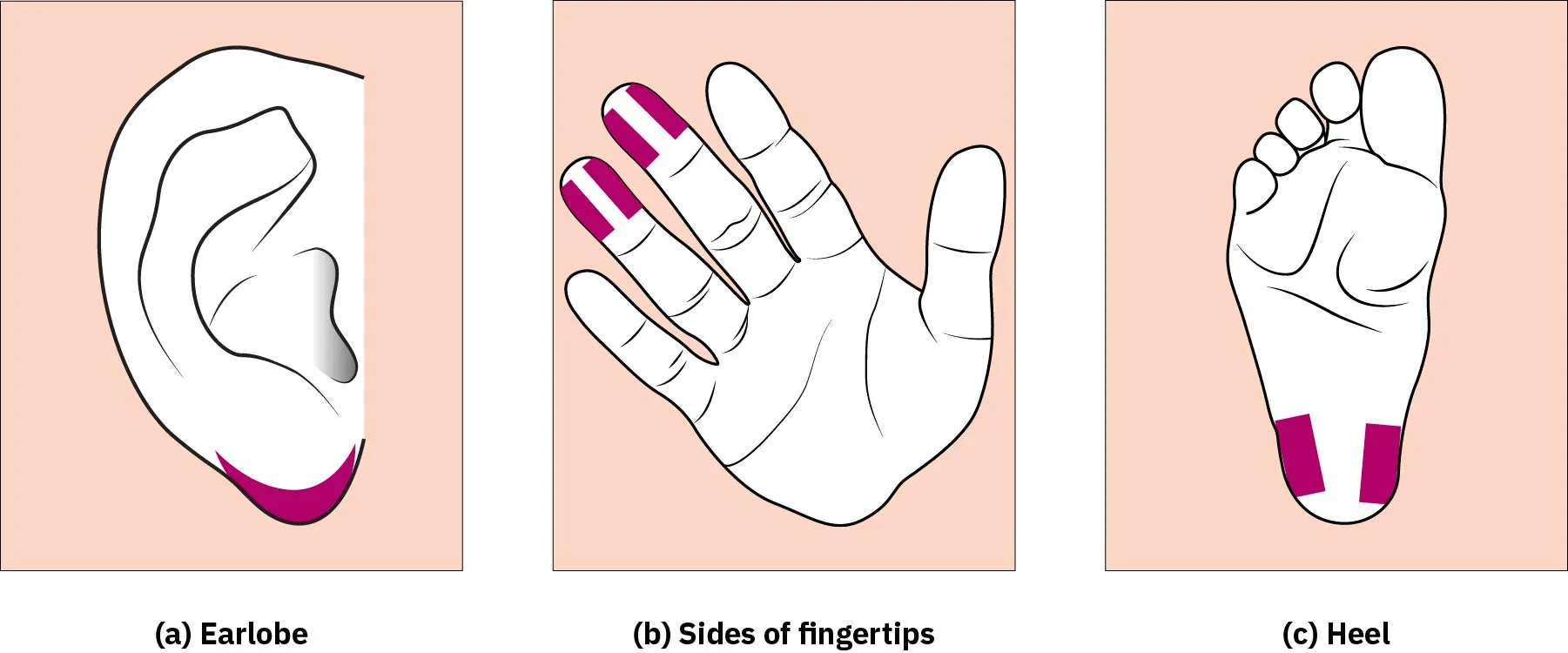 An image showing three puncture sites for capillary blood testing: (a) earlobe, (b) sides of fingertip, and (c) heel.