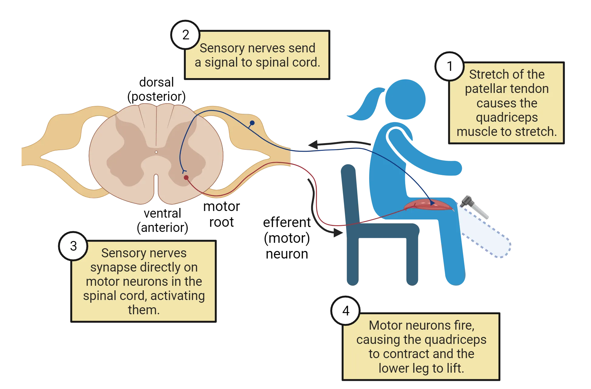 Diagram of a cross-section of spinal cord with input/output connected to a cartoon of a person sitting in a chair with feet on the floor. Incoming, sensory (afferent) neuron is shown with input terminal in the person’s quadricep, cell body in dorsal root ganglia and axon terminals synapsing on an efferent motor neuron in the ventral gray matter of the cord that sends an axon out to a skeletal muscle in the quadriceps. The knee-jerk reflex described in the main text is implied by a hammer on the patella and outline of a leg swinging out.