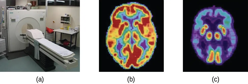 Three pictures are shown and labeled “a,” “b” and “c.” Picture a shows a machine with a round opening connected to an examination table. Picture b is a medical scan of the top of a person’s head and shows large patches of yellow and red and smaller patches of blue, green and purple highlighting. Picture c also shows a medical scan of the top of a person’s head, but this image is mostly colored in blue and purple with very small patches of red and yellow.
