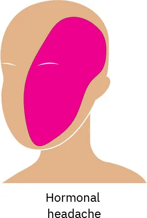 A drawing of a person’s face with a pink highlight on one side, showing where pain caused by hormones is reflected.