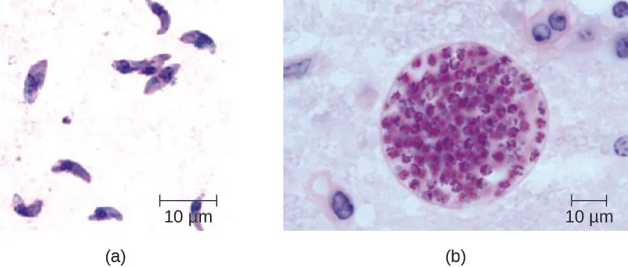 A) A micrograph of curved cells with a nucleus. B) micrograph of a sphere with many smaller spheres inside.