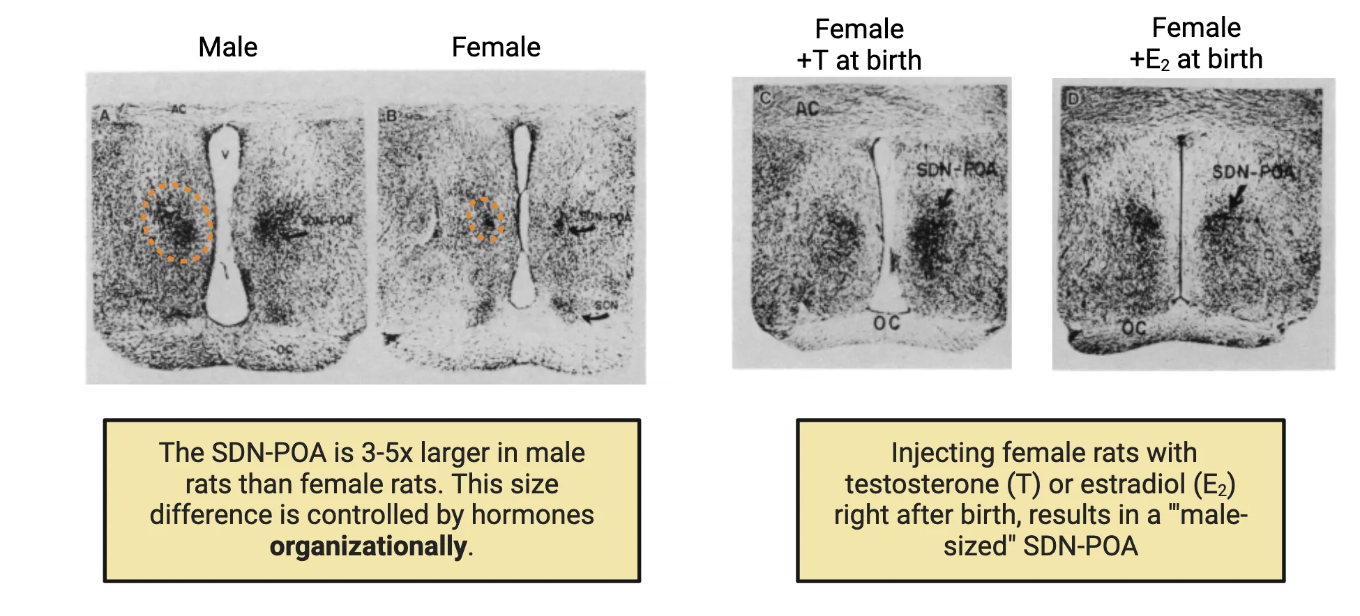 Black and white photomicrographs showing a dark stain to reveal the SDN-POA. The SDN-POA is 3-5x larger in male rats than female rats. This size difference is controlled by hormones organizationally. Injecting female rats with testosterone (T) or estradiol (E2) right after birth, results in a 'male-sized' SDN-POA.
