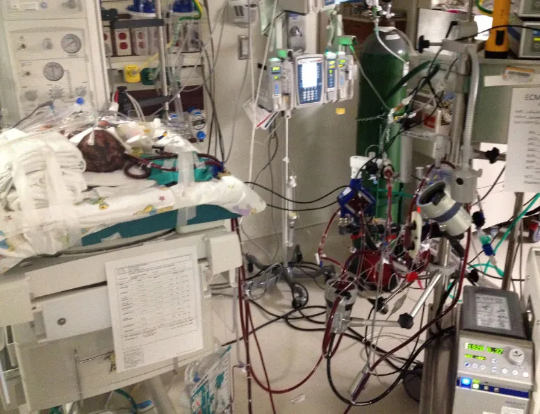 Photograph in a hospital setting showing a complex machine with numerous tubes and monitors around a patient bed.