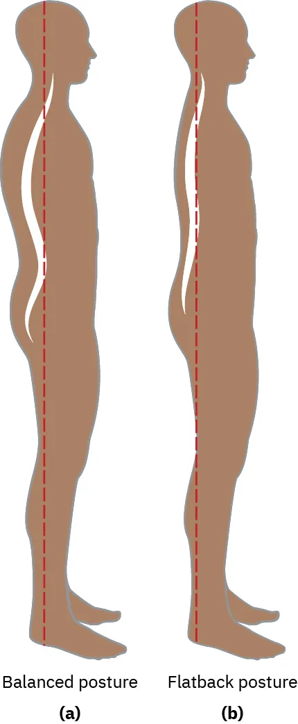 The image illustrates two side profiles of human figures representing different postures. The left figure, labeled "Balanced posture," shows a natural spinal curvature with a dashed line indicating alignment. The right figure, labeled "Flat back posture," depicts a reduced spinal curve with a different alignment, indicated by a second dashed line. Both lines trace the back from head to lower spine, highlighting the postural differences.