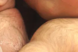 Photo of soft, black hair covering skin of infant.