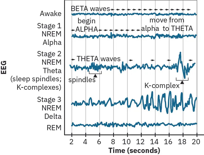 A graph has a y-axis labeled “EEG” and an x-axis labeled “time (seconds).” Plotted along the y-axis and moving upward are the stages of sleep. First is REM, followed by Stage 3 NREM Delta, Stage 2 NREM Theta (sleep spindles; K-complexes), Stage 1 NREM Alpha, and Awake. Charted on the x axis is Time in seconds from 2–20 in 2 second intervals. Each sleep stage has associated wavelengths of varying amplitude and frequency. Relative to the others, “awake” has a very close wavelength and a medium amplitude. Stage 1 is characterized by a generally uniform wavelength and a relatively low amplitude which doubles and quickly reverts to normal every 2 seconds. Stage 2 is comprised of a similar wavelength as stage 1. It introduces the K-complex from seconds 10 through 12 which is a short burst of doubled or tripled amplitude and decreased wavelength. Stage 3 has a more uniform wave with gradually increasing amplitude. Finally, REM sleep looks much like stage 2 without the K-complex.