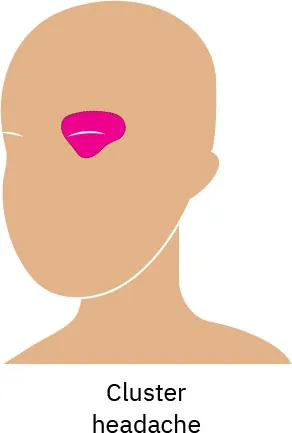 A drawing of a person’s face with a pink highlight over one eye, showing where pain caused by cluster is reflected.
