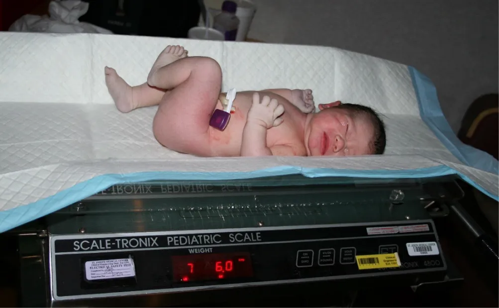 Newborn infant on a Scale-Tronix Pediatric Scale indicating weight of 7.6 lbs.