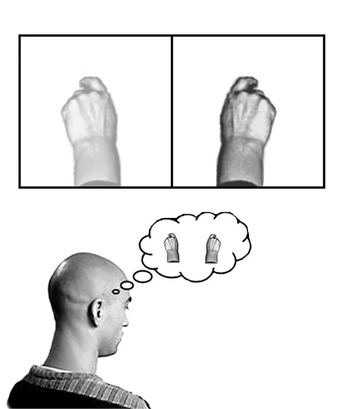 A person thinks of a hand and its mirror image. Mirror therapy helps bring some relief from phantom limb pain.