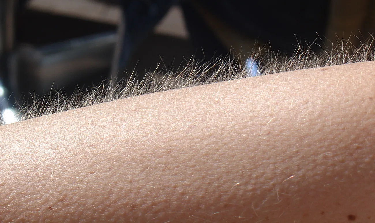Arm showing goosebumps