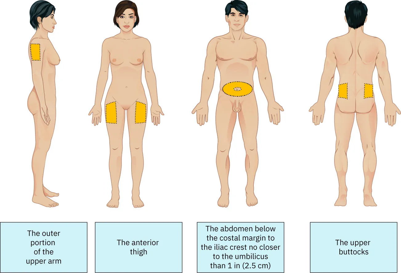 Diagram showing anatomical sites appropriate for SQ injections: outer portion of upper arm, anterior thigh, abdomen below costal margin to iliac crest (no closer to umbilicus than one inch), and upper buttocks.
