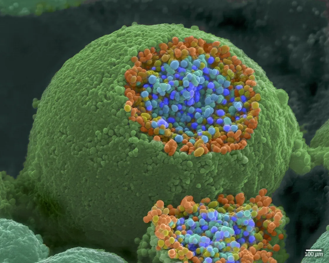 The axon terminal is spherical. A section is sliced off, revealing small blue and orange vesicles just inside.
